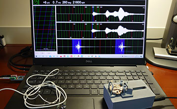 WenshanZhuangandMiaoAutonomousPrefecture RADO Watch Demagnetization (Free of Charge) WenshanZhuangandMiaoAutonomousPrefecture RADO Watch Demagnetization (Free of Charge)